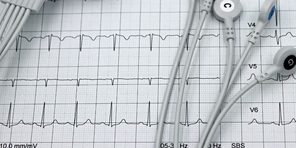 holter prywatnie Mikołów