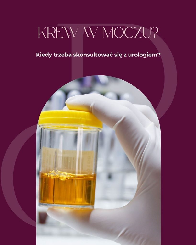Krew w moczu – kiedy potrzebna jest konsultacja urologiczna?
